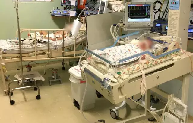 Crianças em UTI pediátrica no pós-operatório da Santa Casa. (Foto: Arquivo pessoal)